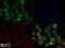 Microtubule Associated Protein 1 Light Chain 3 Beta antibody, NBP2-59800, Novus Biologicals, Immunofluorescence image 