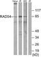 hRAD54 antibody, A03328-1, Boster Biological Technology, Western Blot image 