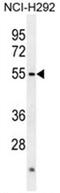 Actin-like protein 7A antibody, AP50069PU-N, Origene, Western Blot image 