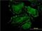 Rho-related GTP-binding protein RhoJ antibody, H00057381-M01, Novus Biologicals, Immunocytochemistry image 