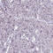 Serine And Arginine Rich Splicing Factor 5 antibody, HPA043484, Atlas Antibodies, Immunohistochemistry paraffin image 