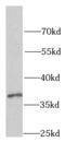 Poly(RC) Binding Protein 1 antibody, FNab03951, FineTest, Western Blot image 