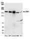 Zinc Finger E-Box Binding Homeobox 1 antibody, A301-922A, Bethyl Labs, Western Blot image 