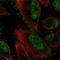 EPH Receptor B2 antibody, HPA071200, Atlas Antibodies, Immunofluorescence image 