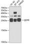 Quinoid Dihydropteridine Reductase antibody, 19-822, ProSci, Western Blot image 