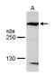 Microtubule Associated Protein 1B antibody, PA5-30584, Invitrogen Antibodies, Western Blot image 