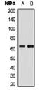 3-Phosphoinositide Dependent Protein Kinase 1 antibody, LS-C368457, Lifespan Biosciences, Western Blot image 