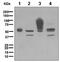Carcinoembryonic Antigen Related Cell Adhesion Molecule 6 antibody, ab134074, Abcam, Western Blot image 