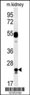 LysM Domain Containing 1 antibody, 62-030, ProSci, Western Blot image 