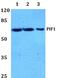 PIF1 5'-To-3' DNA Helicase antibody, GTX18142, GeneTex, Western Blot image 
