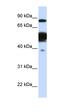 Nexilin F-Actin Binding Protein antibody, orb325383, Biorbyt, Western Blot image 