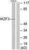 IKAROS Family Zinc Finger 3 antibody, TA315180, Origene, Western Blot image 