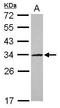 UTP11 Small Subunit Processome Component antibody, GTX115929, GeneTex, Western Blot image 