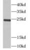 Tubulin Polymerization Promoting Protein antibody, FNab08897, FineTest, Western Blot image 