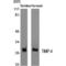 TIMP Metallopeptidase Inhibitor 4 antibody, LS-C386440, Lifespan Biosciences, Western Blot image 