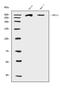 BRCA1 DNA Repair Associated antibody, A00005-2, Boster Biological Technology, Western Blot image 