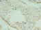 Sperm-associated antigen 16 protein antibody, LS-C378149, Lifespan Biosciences, Immunohistochemistry paraffin image 