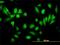 Ribosomal Protein S5 antibody, H00006193-M02, Novus Biologicals, Immunocytochemistry image 