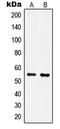rIPK1 antibody, LS-C353526, Lifespan Biosciences, Western Blot image 
