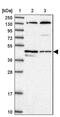 Tubulin Epsilon And Delta Complex 1 antibody, PA5-58637, Invitrogen Antibodies, Western Blot image 