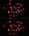 PH Domain And Leucine Rich Repeat Protein Phosphatase 1 antibody, GTX64568, GeneTex, Immunocytochemistry image 