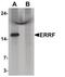 Steroid Receptor Associated And Regulated Protein antibody, PA5-34534, Invitrogen Antibodies, Western Blot image 