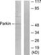 Parkin RBR E3 Ubiquitin Protein Ligase antibody, TA326251, Origene, Western Blot image 