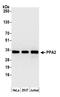 Pyrophosphatase (Inorganic) 2 antibody, A305-539A, Bethyl Labs, Western Blot image 