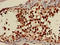 Protein Kinase AMP-Activated Non-Catalytic Subunit Gamma 1 antibody, LS-C679163, Lifespan Biosciences, Immunohistochemistry paraffin image 