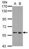 Zinc Finger And SCAN Domain Containing 32 antibody, LS-C155456, Lifespan Biosciences, Western Blot image 