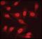 Protein Phosphatase 2 Catalytic Subunit Alpha antibody, LS-C91577, Lifespan Biosciences, Immunofluorescence image 