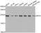 Ribosomal Protein S5 antibody, A04460, Boster Biological Technology, Western Blot image 