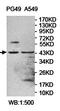 Ankyrin Repeat Domain 42 antibody, orb78192, Biorbyt, Western Blot image 