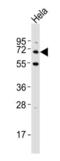 Sequestosome-1 antibody, TA300177, Origene, Western Blot image 