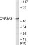 Cytochrome P450 Family 3 Subfamily A Member 4 antibody, EKC1920, Boster Biological Technology, Western Blot image 