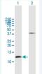 Gonadotropin Releasing Hormone 2 antibody, H00002797-B01P-50ug, Novus Biologicals, Western Blot image 