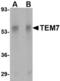 Plexin Domain Containing 1 antibody, TA306475, Origene, Western Blot image 