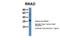RRAD, Ras Related Glycolysis Inhibitor And Calcium Channel Regulator antibody, NBP1-58864, Novus Biologicals, Western Blot image 