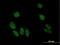 Myosin Light Chain 5 antibody, H00004636-B01P, Novus Biologicals, Immunocytochemistry image 