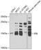 Interferon Alpha Inducible Protein 6 antibody, GTX32668, GeneTex, Western Blot image 