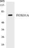 Forkhead Box O1 antibody, EKC1223, Boster Biological Technology, Western Blot image 