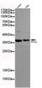 Protein Phosphatase 4 Catalytic Subunit antibody, TA347025, Origene, Western Blot image 
