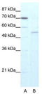 Zinc Finger Protein 665 antibody, TA341397, Origene, Western Blot image 