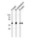 Aldolase, Fructose-Bisphosphate C antibody, LS-B3453, Lifespan Biosciences, Western Blot image 