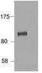 HIC ZBTB Transcriptional Repressor 1 antibody, PA5-37864, Invitrogen Antibodies, Western Blot image 