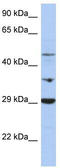 Pyruvate Dehydrogenase Kinase 3 antibody, TA339279, Origene, Western Blot image 