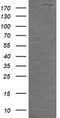 Dedicator of cytokinesis protein 8 antibody, M01771-1, Boster Biological Technology, Western Blot image 