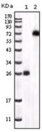Bruton Tyrosine Kinase antibody, TA336560, Origene, Western Blot image 