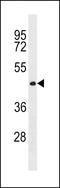 CWC27 Spliceosome Associated Cyclophilin antibody, LS-C203861, Lifespan Biosciences, Western Blot image 