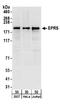 Glutamyl-Prolyl-TRNA Synthetase antibody, A303-957A, Bethyl Labs, Western Blot image 
